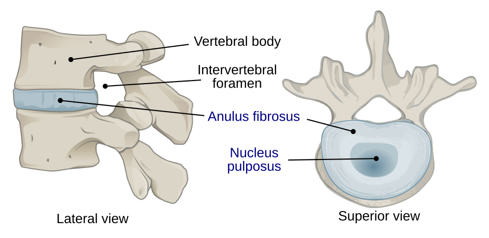 Välilevyn rakenne sivulta ja ylhäältä: nikaman runko, hermojuuriaukko, ulkokehä (anulus fibrosus) ja hyytelömäinen ydin (nucleus pulposus)